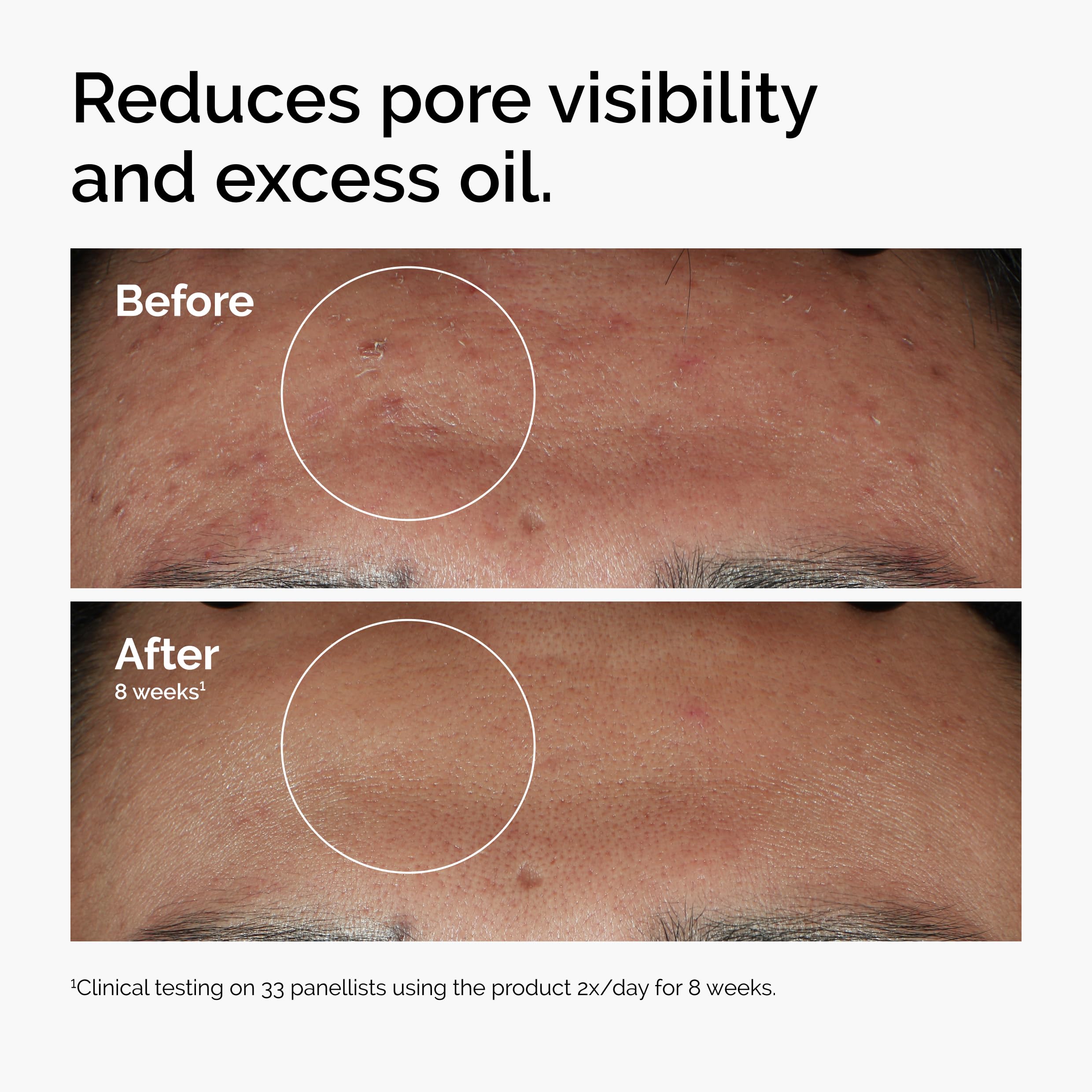The Ordinary Niacinamide 10% Zinc 1% serum USA Beauty Co